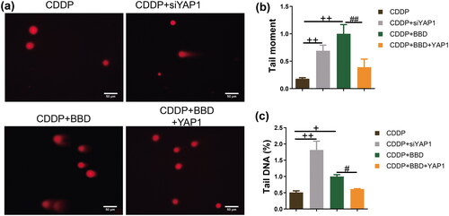 Figure 5. YAP1 Overexpression antagonized the promotional effect of babaodan (BBD) on DNA damage in cholangiocarcinoma cells with cisplatin. (a) The characteristic photos showed the DNA damage (×400, scale bar = 50 μm). The comet assay was used to measure (b) tail moment and (c) percentage of tail DNA, and YAP1 overexpression inhibited (b) tail moment and (c) percentage of tail DNA in cholangiocarcinoma cells with co-treatment of cisplatin and BBD (n = 3). (mean ± standard deviation) +p < 0.05, ++p < 0.01, vs. CDDP group; #p < 0.05, ##p < 0.01, vs. CDDP + BBD group.