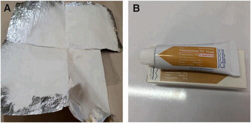 Figure 3. A) Synthesized Myco/NFs/ZnO/Alv nanofibrous mat, B) Commercial Triamcinolone Ointment