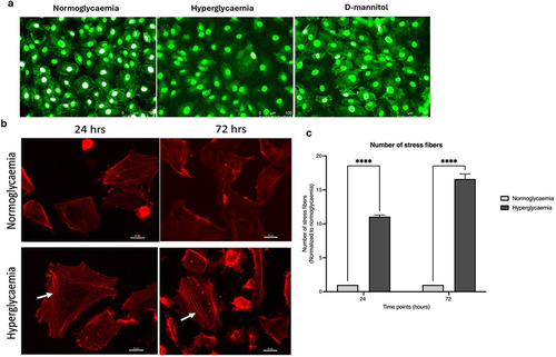 Figure 2. Treatment of human brain microvascular endothelial cells with high glucose (HG) leads to disappearance of tight junction protein, zonula occludens-1 from plasma membrane (a) and increases actin stress fiber formation in a time-dependent manner (b-c) compared to cells subjected to normoglycaemia (NG) or equimolar concentrations of D-mannitol. Scale bars: 100 μm for ZO-1 and 20 μm for actin microfilament staining. All images were captured using 20× magnification. ****p < 0.001 compared to HG group.