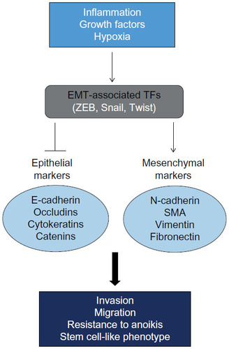 Figure 1 Overview of key molecular players in epithelial–mesenchymal transition.