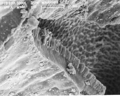 Figure 6 Inner cells of seed in lateral view (2000×) through SEM