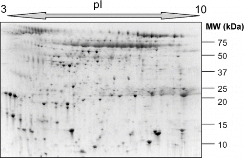 Figure 1 A typical 2-DGE profile of human induced sputum from a COPD patient demonstrating the distribution in molecular weight (MW) and isoelectric point (pI) of proteins in this biofluid.