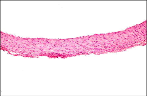 Figure 3 Atherodiet + C. decidua. fruit extract (group 3): Microphotograph of thoracic aorta showing normal histology without any atherosclerotic lesions (× 100, HE).