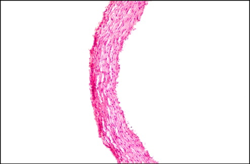 Figure 1 Intact control (group 1): Microphotograph of thoracic aorta exhibiting normal histology with aorta wall consisting of tunica intima, media, and adventitia (× 100, HE).