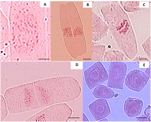 Figure 2. Mitotic phases of root tip cells of teak plants: (A) prophase, (B) metaphase, (C) anaphase, (D) telophase, and (E) interphase, bar = 10 µm.