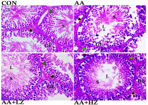 Figure 1. Photomicrograph showing the histoarchitecture changes, Sertoli cell count, Leydig cell count, Germ cell count, Diameter of the seminiferous tubules, Luminal diameter, and Epithelial height of the testis. Control group revealed normal arrangement of the seminiferous tubules epithelium, clusters of sperm cells at the lumen, statistical significant increase in germ cell and Sertoli cell (**p < 0.001), and statistically significant increase in the number of Leydig cells (*p < 0.001). AA group revealed severe degeneration of seminiferous tubules epithelium, loss of sperm cells at the lumen, and degeneration of the interstitial cells. Significant decrease in germ cell, Sertoli cell and Leydig cell count (*p < 0.001) when compared with the control group. There was also a significant increase in the luminal diameter and epithelial height when compared to other group (*p < 0.001). AA + LZ group revealed moderate degeneration of seminiferous tubules epithelium, loss of sperm cells at the lumen and statistically significant increase in the Leydig cells, Sertoli cells and germ cells count when compared with the AA group (*p < 0.001, **p < 0.01). There was also a significant reduction in luminal diameter and epithelial height when compared with AA group (*p < 0.001, **p < 0.01). AA + HZ group revealed moderate loss of seminiferous tubules epithelium, statistical increase in interstitial cells, germ cell, and Sertoli cell when compared with AA group (**p < 0.001), and a significant reduction in the luminal diameter when compared with AA group. (Black arrow: Leydig cells, Green arrow: myoid cells, GE: Germinal epithelium, L: Lumen, S: Spermatids.) Photomicrograph at x800 magnification, using H&E staining.