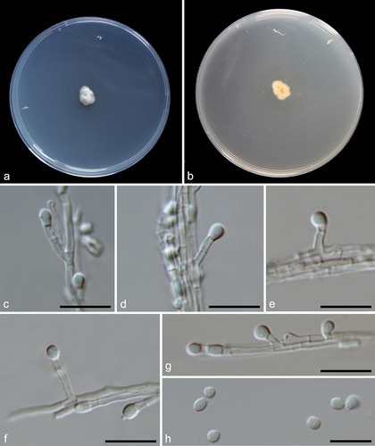 Figure 10. Preussia sedimenticola (from ex-holotype CGMCC 3.27276). (a–b) Surface and reverse colony on PDA. (c–g) Conidiogenous cells and conidia. (h) Conidia. Scale bars: c–h = 10 µm.
