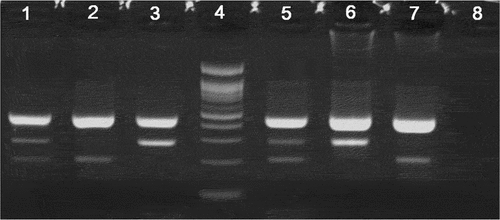 Figure 1. Electrophoresis pattern for identification of the FTO rs9939609 genotypes. Lanes 1 and 5: AT genotype; lanes 2 and 7: AA genotype; lanes 3 and 6: TT genotype; lane 4: 100 bp DNA ladder; lane 8: NTC (non-template control).