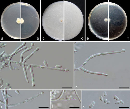 Figure 4. Emericellopsis ovoidea (from ex-holotype CGMCC 3.27273). (a–b) Surface and reverse of the colony on PDA. (c–d) Surface and reverse of the colony on OA. (e–f) Surface and reverse of the colony on MEA. (g–j) Conidiogenous cells and conidia. (k) Conidia. Scale bars: g–k = 10 µm.