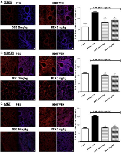 Figure 5. Effect of therapeutic OBE treatment, at a single dose of 60 mg/kg; i.p, on the HDM-induced expression of phosphorylated (A) EGFR (B) ERK1/2 and (C) AKT. Lung sections were obtained from the treatment groups; PBS-challenged mice post-treated with vehicle (PBS group), HDM-challenged mice post-treated with vehicle (HDM group), HDM-challenged mice post-treated with OBE (60 mg/kg; i.p) (OBE group) and HDM-challenged mice post-treated with DEX (3 mg/kg; i.p) (DEX group), thereafter these lung sections were immunostained for pEGFR, pERK1/2 and pAKT. The left-hand panel displays the expression of pEGFR, pERK1/2 and pAKT (red), whilst the right-hand panel displays the overlay with DAPI (blue), scale bar = 50 µm. Bar graphs represent the quantitative assessment of fluorescence intensity of pEGFR, pERK1/2 and pAKT (arbitrary units). Data are expressed as mean ± SEM (n = 4–5). *p < 0.05 vs. time-matched PBS-challenged mice, #p < 0.05 vs. HDM-challenged mice (Kruskal-Wallis test followed by Dunn’s multiple comparison test).