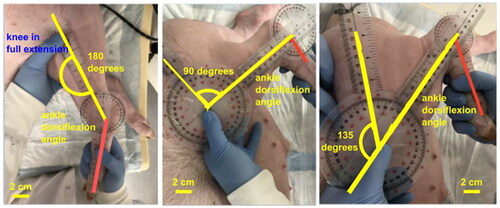 Figure 1. Photographs of goniometry measurement of the ankle range of motion with the knee stabilized in (a) full extension of 0°, (b) flexion of 90°, and (c) flexion of 135° flexion, while the angle of the ankle at maximal dorsiflexion was measured.