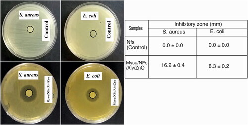 Figure 14. The antibacterial activity of electrospun NFs against S. aureus and E. coli bacteria. Data are expressed as mean ± standard deviation (n = 3).