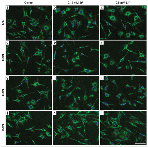 Figure 2. Fluorescence micrographs of cells labeled with FITC-phalloidin and DAPI. Cells were cultured for 24 hours. The actin cytoskeleton is shown in green and the nuclei in blue. The cells were well adhered and spread in all analyzed conditions. They often presented a stellate shape with distinct prolongations. Scale bar: 50 μm.