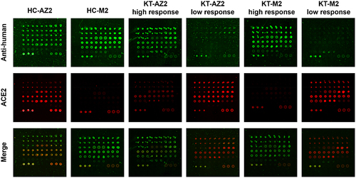 Figure 1. The images of total antibodies and ACE2 bindings in HC and KT. The assay procedures involve the simultaneous quantification of total antibodies and surrogate neutralizing. The total antibodies in the serum were quantified using a Cy3-labelled anti-human IgG+IgA+IgM antibody. Concurrently, the surrogate neutralizing was quantified using Cy5-labelled ACE2.
