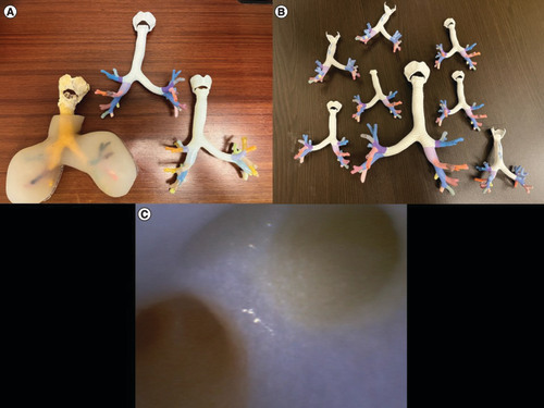 Figure 1. 3DP tracheobronchial models. (A) From left to right second–fourth iteration of the model. (B) Half-size take home color-coded models. (C ) Bronchoscopic view of right-upper lobe. On the left is the anterior segment colored orange, at the top is the apical segment colored light gray, and on the right is the posterior segment colored yellow.