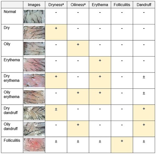 Figure 1. Classification of scalp types. scalp photographic index-artificial intelligence (SPI-AI) diagnosed a feature of grade ≥2 as positive and classified the scalp type according to the positivity. aIf both dryness and oiliness were positive in one scalp area, only oiliness of grade 3 was considered positive. For example, a scalp with grade 2 or 3 dryness, grade 2 oiliness, grade 2 or 3 erythema could be defined as a dry erythema type.