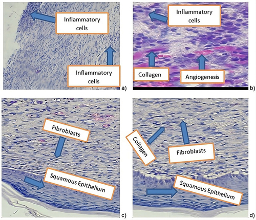 Figure 4 Photograph of the histological specimen of excision wound tissue. (a) Histological section of simple ointment; (b) Histological section of 5% crude extract; (c) Histological section of 10% crude extract; (d) Histological section of Nitrofurazone.