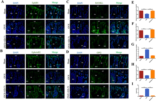 Figure 2 ED-71 activates EphrinB2-EphB4 signaling and decreases RANKL/OPG ratio. (A-D) The immunofluorescence staining of EphB4, EphrinB2, RANKL, OPG in rat femur in Sham, OVX, OVX+ED-71 groups at 8 weeks. Bar, 75μm. (E-H) The statistical analysis of fluorescence intensity of EphB4, EphrinB2, RANKL, OPG. (I) Relative ratio of RANKL to OPG in rat femur at 8 weeks. Error bars stand for mean ± SD (n=5). ***P < 0.001.