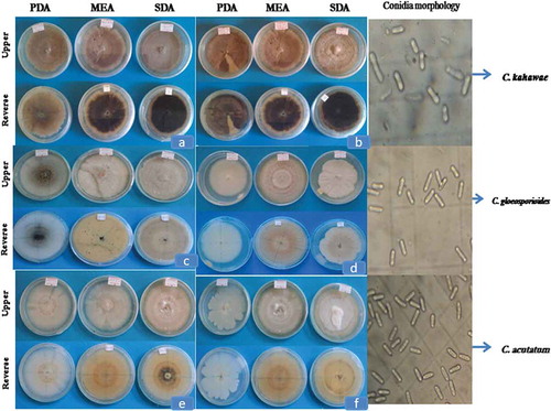 Figure 1. Colony characteristics of Colletotrichum species isolated from diseased coffee berry where (a) CBD007, (b) CBD33, (c) CBD014, (d) CBD119, (e) CBD005 and (f) CBD099 (PDA, Potato Dextrose agar; MEA, Malt Extract Agar; SDA, Sabouraud Dextrose Agar)