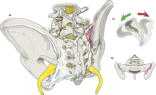 Figure 1 Anatomy of the SIJ. (a) Posterior-oblique view of the sacrum and iliac bones, ligaments, and nervous supply. SIJ is highlighted in pink overlay. (b) Diarthrodial nature of the SIJ space (pink overlay). The joint consists of an anterior one-third consisting of synovium and posterior two-thirds which is primarily ligamentous. (c) Exaggeration of sacral movement in nutation and counternutation. Original medical illustration by Kamil Sochacki, DO.