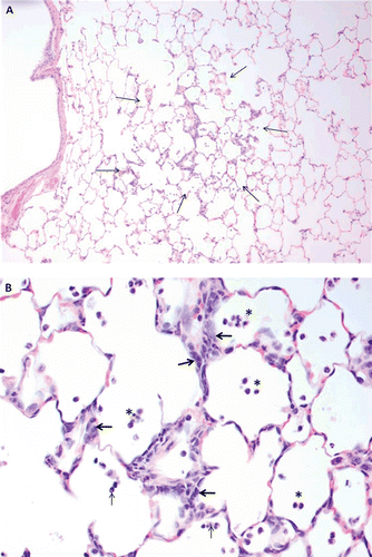 Figure 7.  Histopathology of tire and road wear particles (TRWP) exposure. (A) Low power magnification of focal area of subacute inflammation in the lung. The perimeter is outlined by arrows to demonstrate the limited focal extent of minimal alteration. (B) Higher power magnification to illustrate infiltration of low numbers of mononuclear inflammatory cells interstitial in the thickened interalveolar wall and in alveolar spaces (asterisks) with few neutrophils (thin arrows). Hyperplasia of acinar lining epithelial cells indicated pneumocyte regeneration (thick arrows).