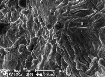 Figure 4 Surface characters of distal end showing papillae in SEM.