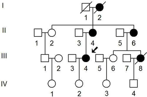 Figure 1 T2DM pedigree information carrying m.A5826G and m.C14668T mutations. Affected individuals (I-2; II-4, II-6, III-4 and III-8) are indicated by filled symbols. Diagonal lines (I-1, I-2 and III-8) are used to show that persons are deceased, arrow shows the proband (III-4).