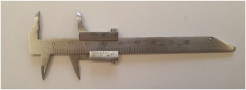 Figure 2. Digital calibrated caliper; used for size assessment of oral lesions before and after treatment