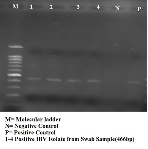 Figure 4 IBV detected with general primer using RT-PCR.