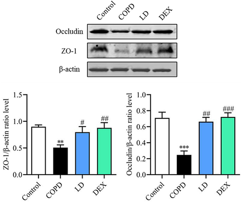 Figure 4 LD partially restored the barrier function of the impaired small intestine in COPD mice. ZO-1 and Occludin-1 protein levels in the small intestine were analyzed by Western blot. Data are presented as mean ± SEM, n = 3. **P <0.01 and ***P <0.001 vs Control group; #P < 0.05, ##P < 0.01 and ###P < 0.001 vs COPD group.
