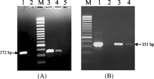 Figure 2 Agarose gel electrophoresis of RT-PCR products from infected Vero cells with or without BExt using PPRV-specific primers (A) Fl and F2 and (B) NP3a and NP4. (A, B) Lane 1: PPRV grown vero cell without BExt as positive control Lane 2: Uninfected vero cell as negative control. Lane M: 100 bp plus DNA ladder (MBI, Fermentas, USA). (A) Lanes 3, 4 and 5: PPRV grown Vero cell with BExt at concentrations of 100, 150, and 200 μg/mL, respectively. (B) Lanes 3 and 4: PPRV grown Vero cell with BExt at concentrations of 150 and 200 μg/mL, respectively.