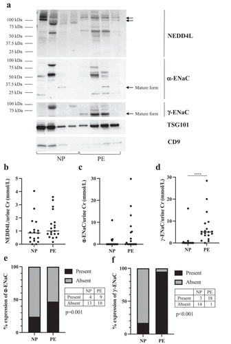 Figure 1. Expression of antibodies directed against NEDD4L, α-ENaC and γ-ENaC on Western blot in normotensive pregnant controls (NP, n = 17) and pre-eclamptic patients (PE, n = 19) normalized to spot urine creatinine (mmol/L). Data are presented as scatter plots, with each patient’s densitometry value represented as a dot and the horizontal line is the median of the sample. (a) A representative Western blot of four NP patients and four PE patients with antibodies against NEDD4L, α-ENaC, and γ-ENaC, as well as vesicle markers TSG101 and CD9. (b) Densitometry analysis of NEDD4L (110 and 130kDa bands) showed no difference between the two groups (p = 0.17). (c) The 30kDa band of α-ENaC was quantified. Densitometry analysis did not show a significantly increased expression of α-ENaC in PE group compared to NP (p = 0.10). (d) For γ-ENaC, the 70kDa band was quantified. Densitometry analysis showed a 6.9-fold increased expression of γ-ENaC in PE group compared to NP (p < 0.0001). (e) Percentage of α-ENaC expression in NP and PE groups. (f) Percentage of γ-ENaC expression in NP and PE groups.