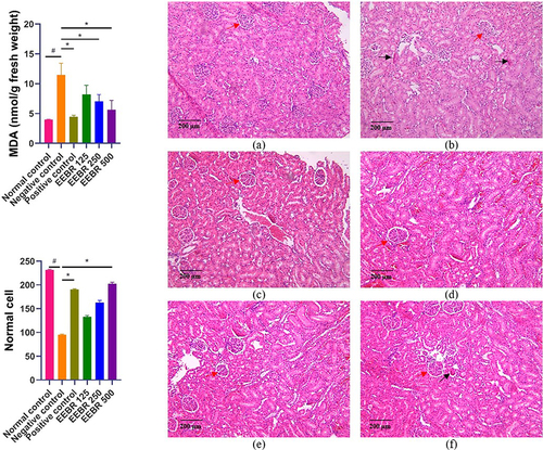 Figure 3 Effect of EEBR on MDA level and viability of kidney cells in cisplatin-induced nephrotoxicity rats. The * indicates a remarkable difference with the negative control (p<0.05). The # indicates a remarkable difference from the normal control group (p<0.05). Histology of the kidney tissue of rats in (a) normal control; (b) negative control; (c) positive control; (d) EEBR 125 mg/kg BW; (e) EEBR 250 mg/kg BW; (f) EEBR 500 mg/kg BW. Red arrows show the Bowman capsule. Inflammatory cells are shown by black arrows.