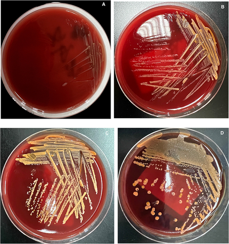 Figure 3 Different incubation time of the colony growth characteristics of G. terrae subculture on Columbia blood agar:24h (A), 48h (B), 72h (C), 120h (D).