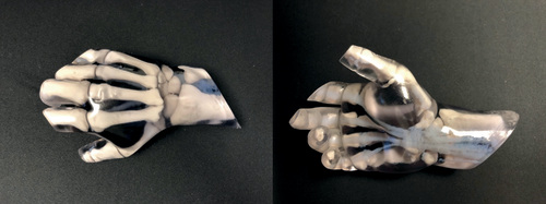 Figure 3. 3D printing model of the hand in presurgical preparation for hand surgery.Note modeling of bones (yellow) as well as the locations of flexor tendon sheaths (white) within a clear construct.