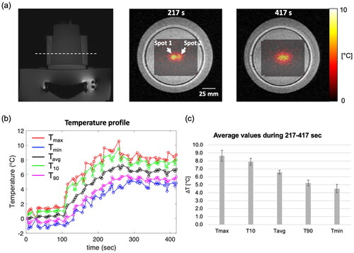 Figure 9. The results of hyperthermia heating on a tissue-mimicking phantom. (a) MR temperature maps overlaid on the corresponding magnitude image at the point when the temperature reached the target temperature and at the end of the experiment. The white-dashed line shows the acquired slice during the experiment. (b) Time-dependent profile of the temperature within a circular ROI with a diameter of 10 pixels (10.9 mm) at the center of the heated region. (c) Average values of Tmax, T10, Tavg, T90 and Tmin during steady-state time interval of 217–417.