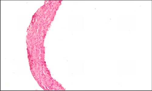 Figure 4 Atherodiet + pitavastatin (group 4): Microphotograph of thoracic aorta showing normal histology without any atherosclerotic lesions (× 100, HE).