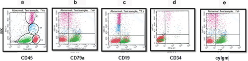 Figure 3. Pre-B ALL. The blasts were selected and gated as they appear on the CD45 and SSC (green) (a). Shown are plots of cyCd79a versus SSC (b), CD19 versus SSC (c), CD34 versus SSC (d), and cyIgM versus SSC (e).