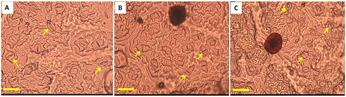 Figure 6. The comparison of the size and density of stomata from induced tetraploid, mixoploid and control diploids under magnification of 400x and observation field of 350x250 µm2 (A) tetraploid, (B) mixoploid, and (C) diploid. Bar = 50 µm, arrows mark the stomata.
