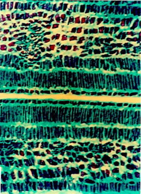 Figure 9 Cellular structure of cotyledon.