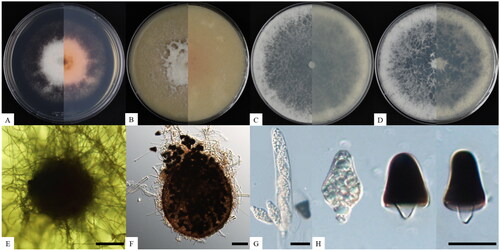 Figure 1. Cultural and morphological characteristics of Triangularia manubriata KNUF-21-020. Cultures were grown at 25 °C for seven days. (A–D) Front and reverse view of the colony on PDA, OA, MEA, and PCA, respectively; (E, F) ascomata produced on PDA; (G) asci; (H) premature (hyaline) and matured (melanized) ascospore. Scale bars: E, F = 50 µm, G, H = 20 µm.