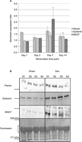 Figure 3 Impact of denervation on plectin, dystonin, and MACF protein expression levels.