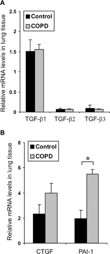 Figure 1 Expression of TGF-β isoforms in COPD lung tissue. Relative mRNA expression levels of TGF-β 1-3 (A), CTGF and PAI-1 (B) in control and COPD IV lung tissues as analyzed by quantitative real-time RT-PCR. The mRNA levels were normalized to the expression levels of a control gene (TBP, tata binding protein) and are expressed relative to control-1 (set to 1). The error bars represent standard error of the mean of the samples (n = 5).*, p < 0.05.