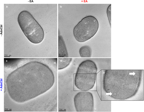 Figure 4. Transmission electron microscopy (TEM) of L. brevis ATCC 14869 reveals bacterial microcompartment formation.