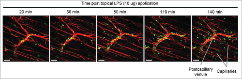 Figure 6. In vivo imaging of inflammatory agent on muscle tissue. Snapshot images of the inner muscle fiber layer from in vivo imaging after topical application of LPS (10 μg) on the tibialis anterior skeletal muscle of a LysM-GFP mouse. GFP-high myeloid cells (mostly neutrophils) extravasate from the blood vessels (red; labeled via i.v. injection of Evans Blue). Excitation: 950 nm using a Ti:Sapphire laser. Scale bar: 50 μm.