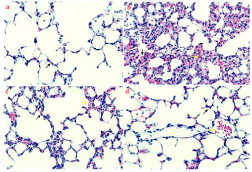 Figure 3. Effects of UTI on pathological injury of lung tissue in LPS-induced rats. Magnification: 100 × . A: Control group, normal alveoli (asterisk) and alveolar septa (black arrow) with few neutrophils are shown; B: model group, with thickened septum (asterisk), alveolar bleeding (black arrow) as well as considerable cell infiltration and alveolar fibrin deposition (yellow arrow); C: DXM group, with significantly alleviated cell infiltration and alveolar fibrin deposition; D: UTI group, with significantly alleviated cell infiltration and alveolar fibrin deposition.