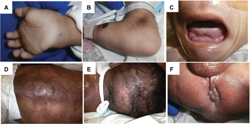 Figure 2 Clinical findings of patient and skin biopsy.
