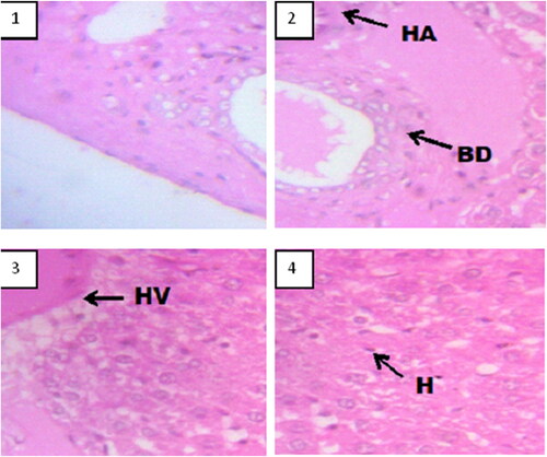Figure 4. Figure of lung (Hematoxylin and eosin. H and E × 100). (1) Control group, shows normal stomach mucosa (M), (2) 100 mg/kg shows normal features, (3) 200 mg/kg shows normal features, and (4) 400 mg/kg shows normal features.