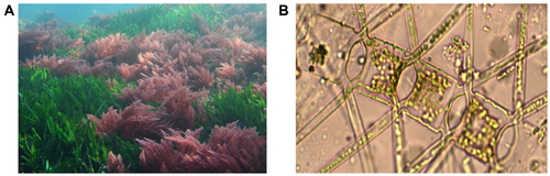 Figure 1 Invasive Asparagopsis taxiformis thrive in endemic Posidonia oceanica seagrass beds at CO2 seeps in the Mediterranean (A). Fish farmers are facing increased losses due to blooms of spiky phytoplankton, such as this Chaetoceros sp., which are resilient to rising CO2 levels but damage gills and can kill fish (B).