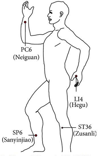 Figure 1 Illustration of the acupoints.